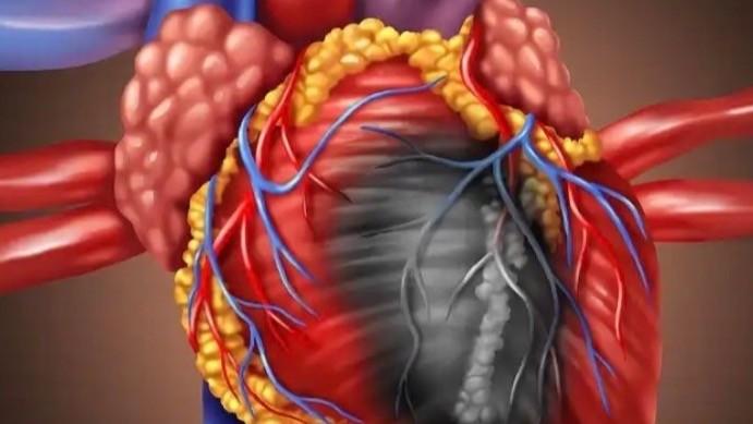  心脏骤停的生死博弈：从生理机制到技术干预的深度剖析 健康养生