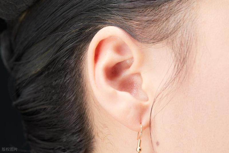  从皮脂腺分泌到脂溢性皮炎：耳缘黄渍的系统性认知与科学应对 健康养生